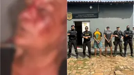 Justiça determina prisão de suspeitos de agredir idosa para roubar R$ 10 mil (Foto: Reprodução)