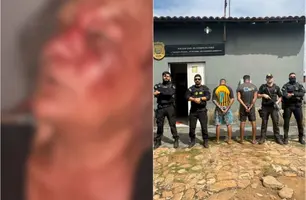 Justiça determina prisão de suspeitos de agredir idosa para roubar R$ 10 mil (Foto: Reprodução)