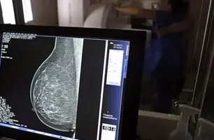 Lei amplia direito a exames preventivos sem desconto salarial (Foto: José Cruz/Agência Brasil)