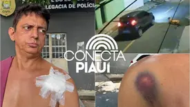 'Nem conversou, só atirou', diz homem baleado por motorista de app em Teresina (Foto: Reprodução)