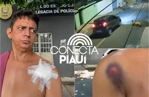 'Nem conversou, só atirou', diz homem baleado por motorista de app em Teresina (Foto: Reprodução)