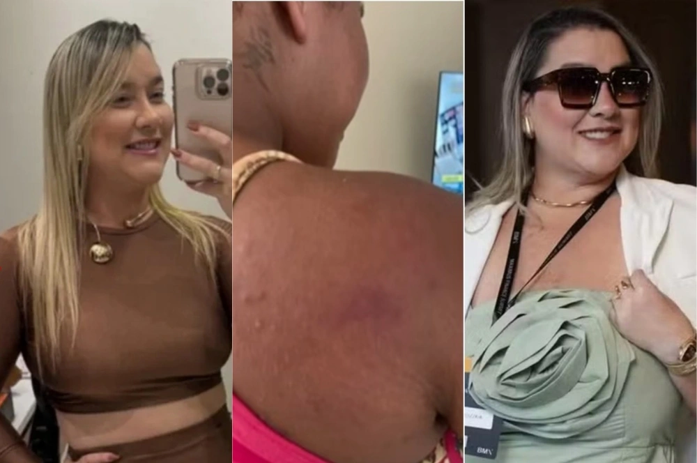 Ex-patroa é presa em Teresina por agredir empregada doméstica grávida no Maranhão