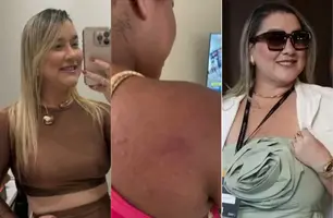 Ex-patroa é presa em Teresina por agredir empregada doméstica grávida no Maranhão (Foto: Reprodução)
