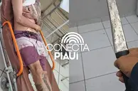 Homem é conduzido à delegacia após esfaquear desafeto em Cocal dos Alves