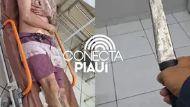 Homem é conduzido à delegacia após esfaquear desafeto em Cocal dos Alves (Foto: Reprodução)