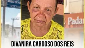 Idosa desaparecida (Foto: Reprodução)