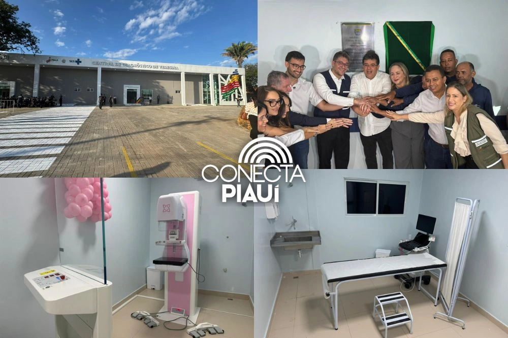 Teresina ganha Central de Diagnóstico com capacidade para 15 mil exames