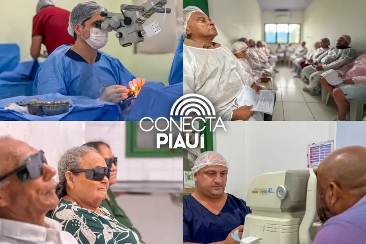 Parnaíba realiza mutirão de catarata e ultrapassa 2 mil cirurgias em 2026