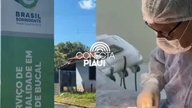 SESB amplia atendimento especializado em saúde bucal à população (Foto: Reprodução)