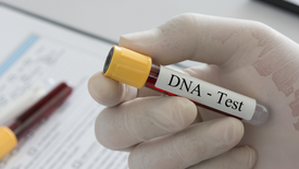 Teste de DNA (Foto: Reprodução)